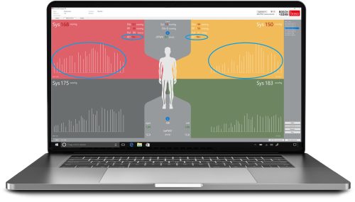 ABI/ABPM/BIA-Software - Lizenzgebühr