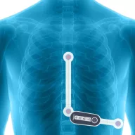 Getemed HeartX Holter 