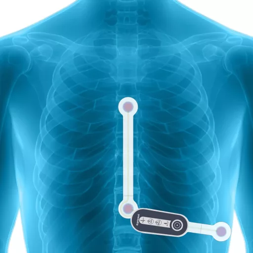 Getemed HeartX Holter