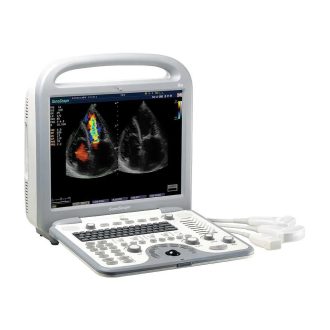 SonoScape S8 Exp portable ultrasound device