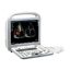 SonoScape S8 Exp portable ultrasound device