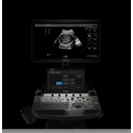   SonoScape P60 Trolley Farbdoppler-Ultraschallgerät, Wis+ Plattform