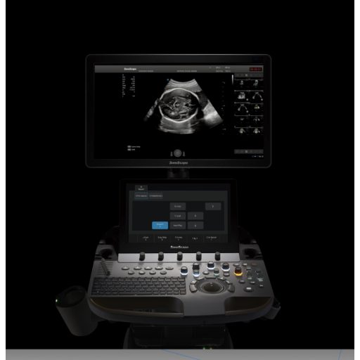 SonoScape P60 Trolley Color Doppler Ultrasound Machine, Wis+ platform