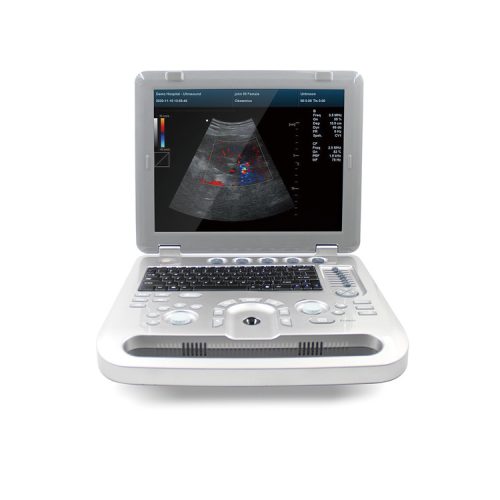 Contec CMS1700A portable color ultrasonic scanner diagnostic system, color doppler + probe