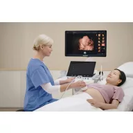 SonoScape P80 Elite-Ultraschallsystem