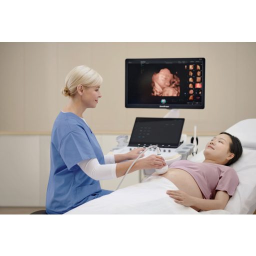 SonoScape P80 Elite Ultrasound System