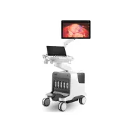 SonoScape P80 Elite-Ultraschallsystem