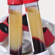 Medifuge CGF Zentrifuge