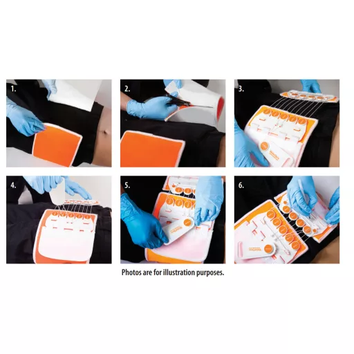 Arrow® T-POD™ Pelvic Stabilization Device