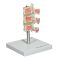 Osteoporosis Model