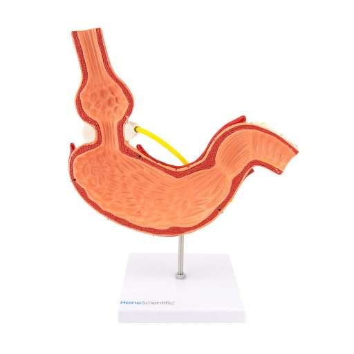 Gastric band model