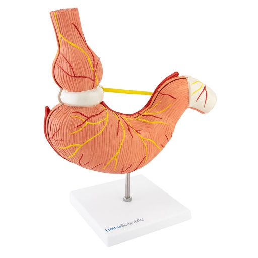 Gastric band model