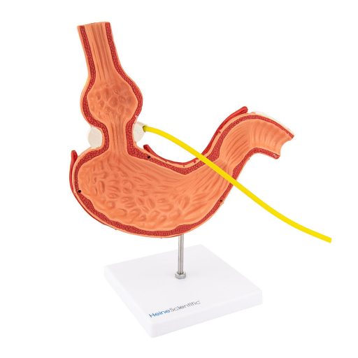 Gastric band model