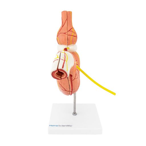 Gastric band model