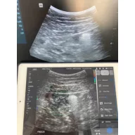   CONTEC CMS 1600B dwusondowy system diagnostyki ultrasonograficznej z kolorowym Dopplerem 32 kanałowa sonda akumulatorowa wypukła i liniowa