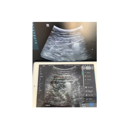 CONTEC CMS 1600B dwusondowy system diagnostyki ultrasonograficznej z kolorowym Dopplerem 32 kanałowa sonda akumulatorowa wypukła i liniowa