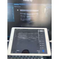   CONTEC CMS 1600B dwusondowy system diagnostyki ultrasonograficznej z kolorowym Dopplerem 32 kanałowa sonda akumulatorowa wypukła i liniowa