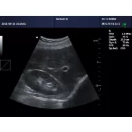   Contec CMS600P2PLUS-VET veterinary ultrasound scanner with PW Doppler, 15" display and convex probe