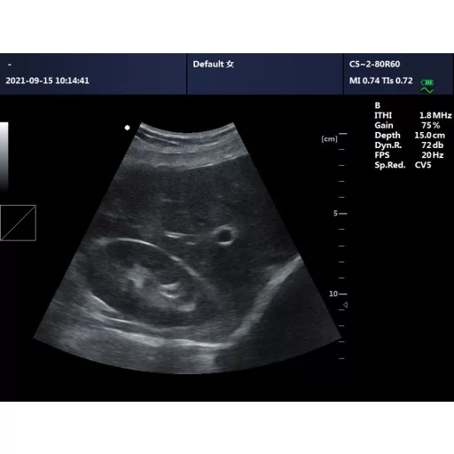 Contec CMS600P2PLUS-VET veterinary ultrasound scanner with PW Doppler, 15" display and convex probe