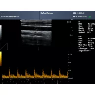  Contec CMS600P2PLUS-VET veterinary ultrasound scanner with PW Doppler, 15" display and convex probe