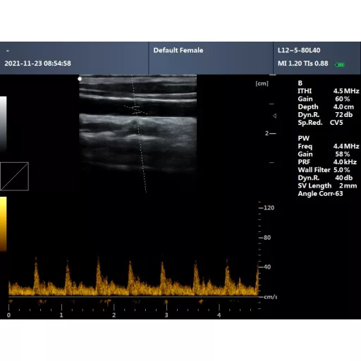 Contec CMS600P2PLUS-VET veterinary ultrasound scanner with PW Doppler, 15" display and convex probe