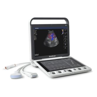 SonoScape S9 portable ultrasound device