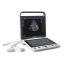 SonoScape S9 portable ultrasound device