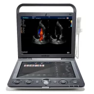 SonoScape S9 tragbares Ultraschallgerät
