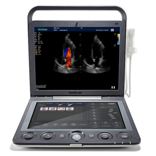 SonoScape S9 portable ultrasound device