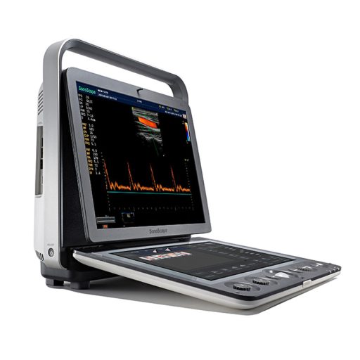 SonoScape S9 portable ultrasound device