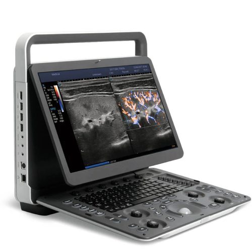 Sonoscape E1 E2 E3 PW Color doppler portable B/W Ultrasound machine