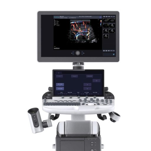 SonoScape P50 Elite ultrasound