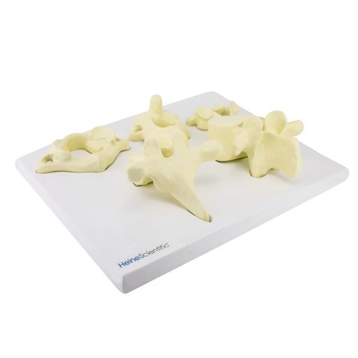 Vertebrae collection