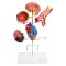 Hypertension model