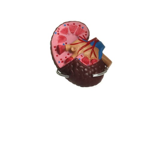 Hypertension model