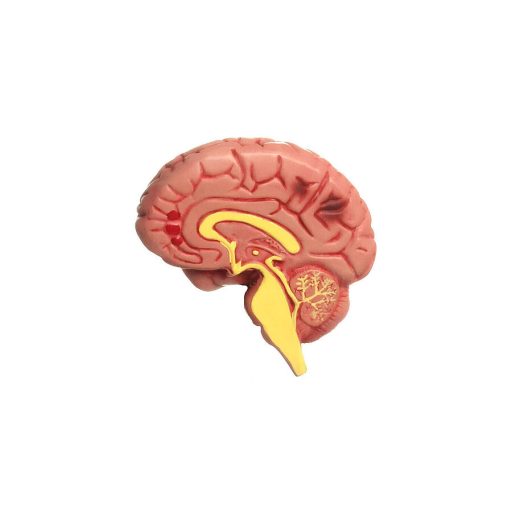 Hypertension model