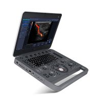 SonoScape X5 tragbares Ultraschallgerät