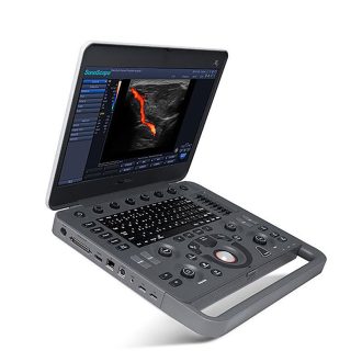 SonoScape X5 portable ultrasound device