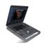 SonoScape X5 portable ultrasound device