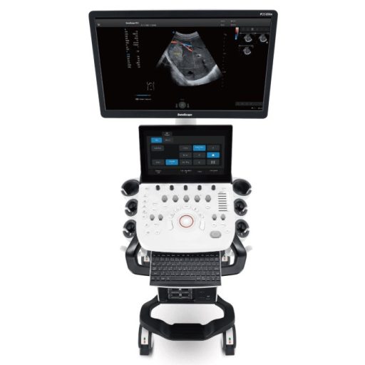 Sonoscape P25 Elite ultrahang készülék