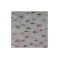 Firefly Video Dermatoscope DE300 ,cable data transfer