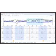 Cardioline Walk Free ECG Holter with analysis software