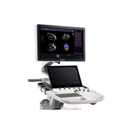 SonoScape P60 EXP ultrasound device