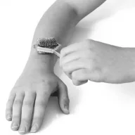 10 point Wartenberg wheel