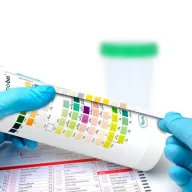   9 paraméteres Roche Diagnostics Combur 9 vizeletteszt, 50 db-os