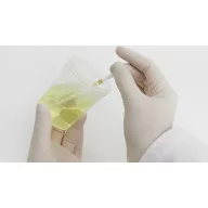   9 paraméteres Roche Diagnostics Combur 9 vizeletteszt, 50 db-os