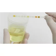   9 paraméteres Roche Diagnostics Combur 9 vizeletteszt, 50 db-os