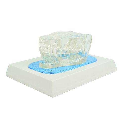 Transparenter Eckkiefer