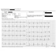 D-Heart Portable ECG Device