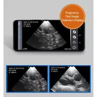 Kabelloses, tragbares Veterinär-Ultraschallgerät